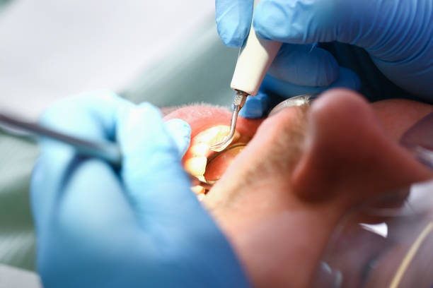 Best Dentist for Severe Toothache  in New Boston, OH